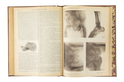 Lot 277 - Deutsche medicinische Wochenschrift, 1896, The first papers on the application of Röntgen or X rays in medicine