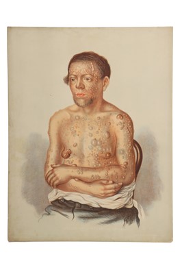 Lot 370 - Medicine - Sydenham Society, Atlas, Diseases of the skin