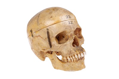 Lot 173 - Victorian Anatomical Human Skull
