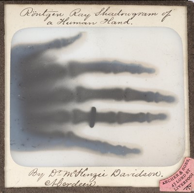 Lot 129 - Magic Lantern Slides, Early X-Ray Shadowgrams