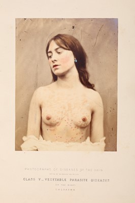 Lot 170 - Squire, Alexander Balmanno, Photographs (Colored from Life) of the Diseases of the Skin