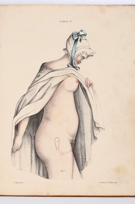 Lot 172 - Spratt, G., Obstetric Tables