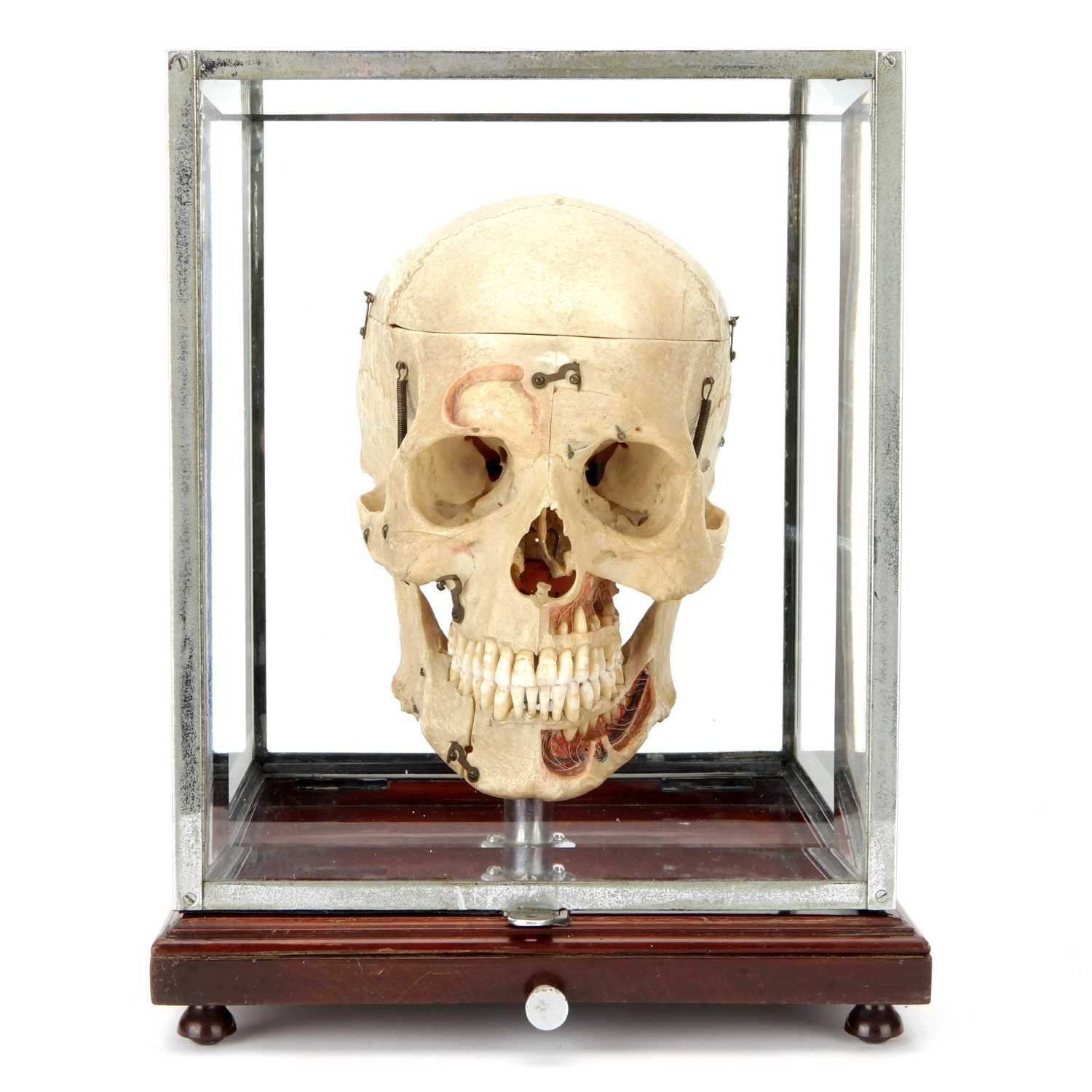 Lot 100 - A Dissected Human Skull