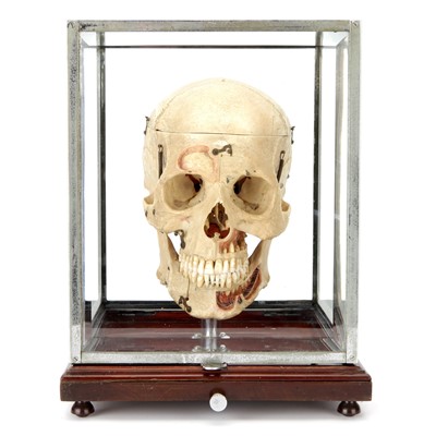 Lot 100 - A Dissected Human Skull