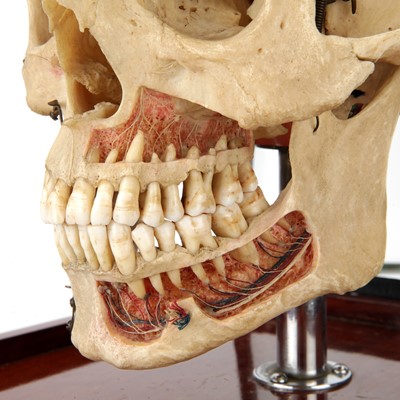 Lot 100 - A Dissected Human Skull