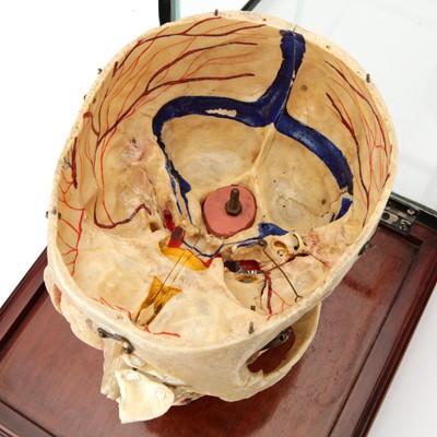 Lot 100 - A Dissected Human Skull