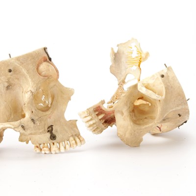 Lot 100 - A Dissected Human Skull