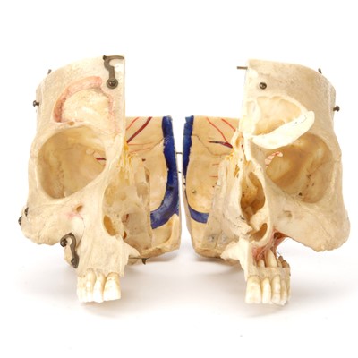 Lot 100 - A Dissected Human Skull
