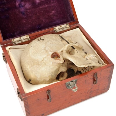 Lot 100 - A Dissected Human Skull